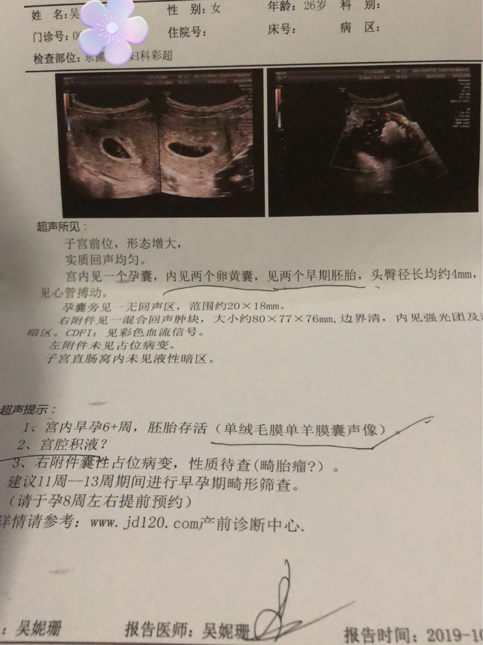 双胎发现畸胎瘤的我是安全怎么渡过孕期的 都怪自己大意了,几年前就