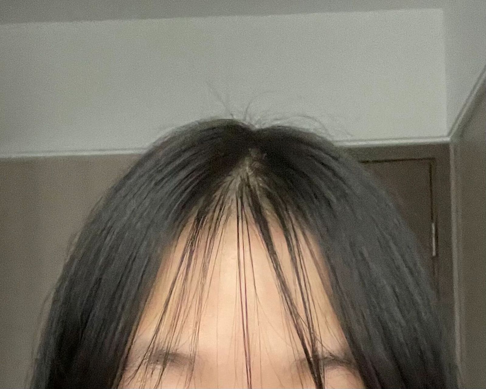 真的很想问问这种刘海该怎么办,不留刘海丑死,但留了它越来越秃,该