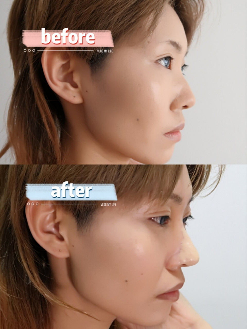 【技巧分享】肤蜡垫鼻子需要注意的细节 出门不太93,拍照完全ok78