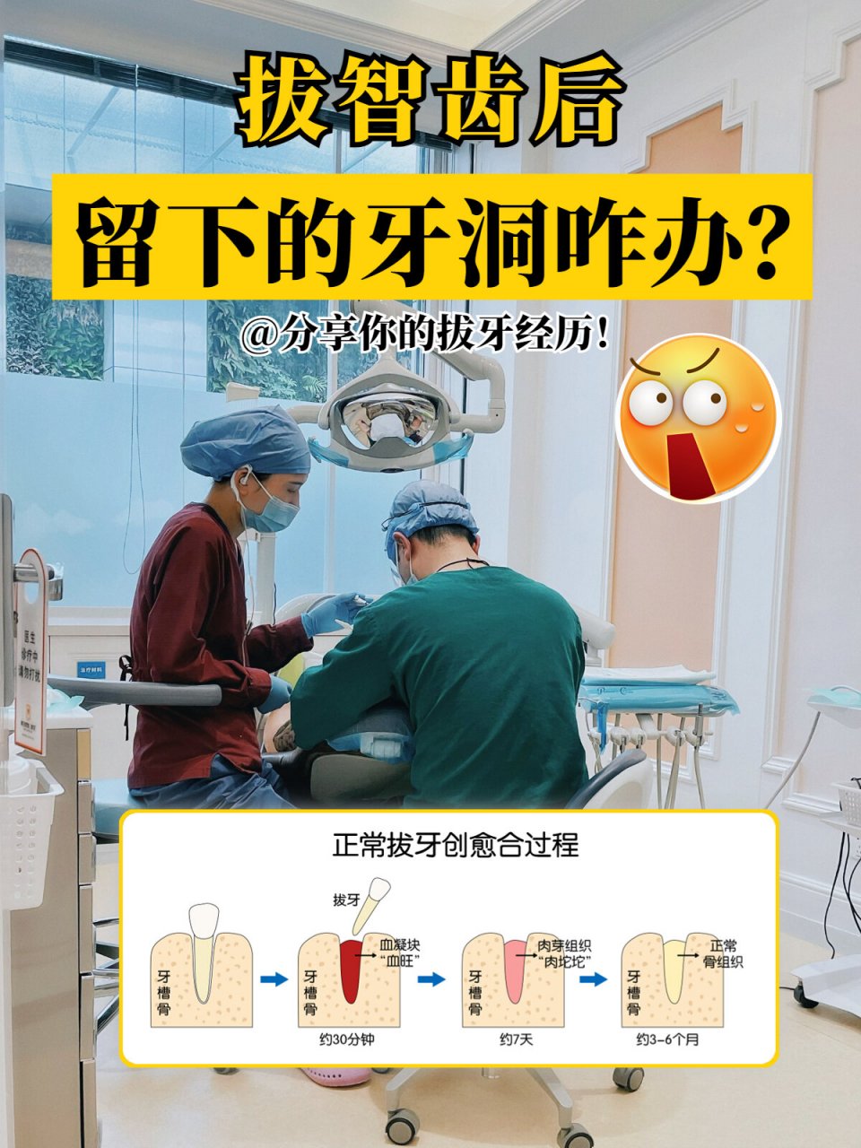 拔牙后的窝洞愈合过程🤔是怎样的呢?