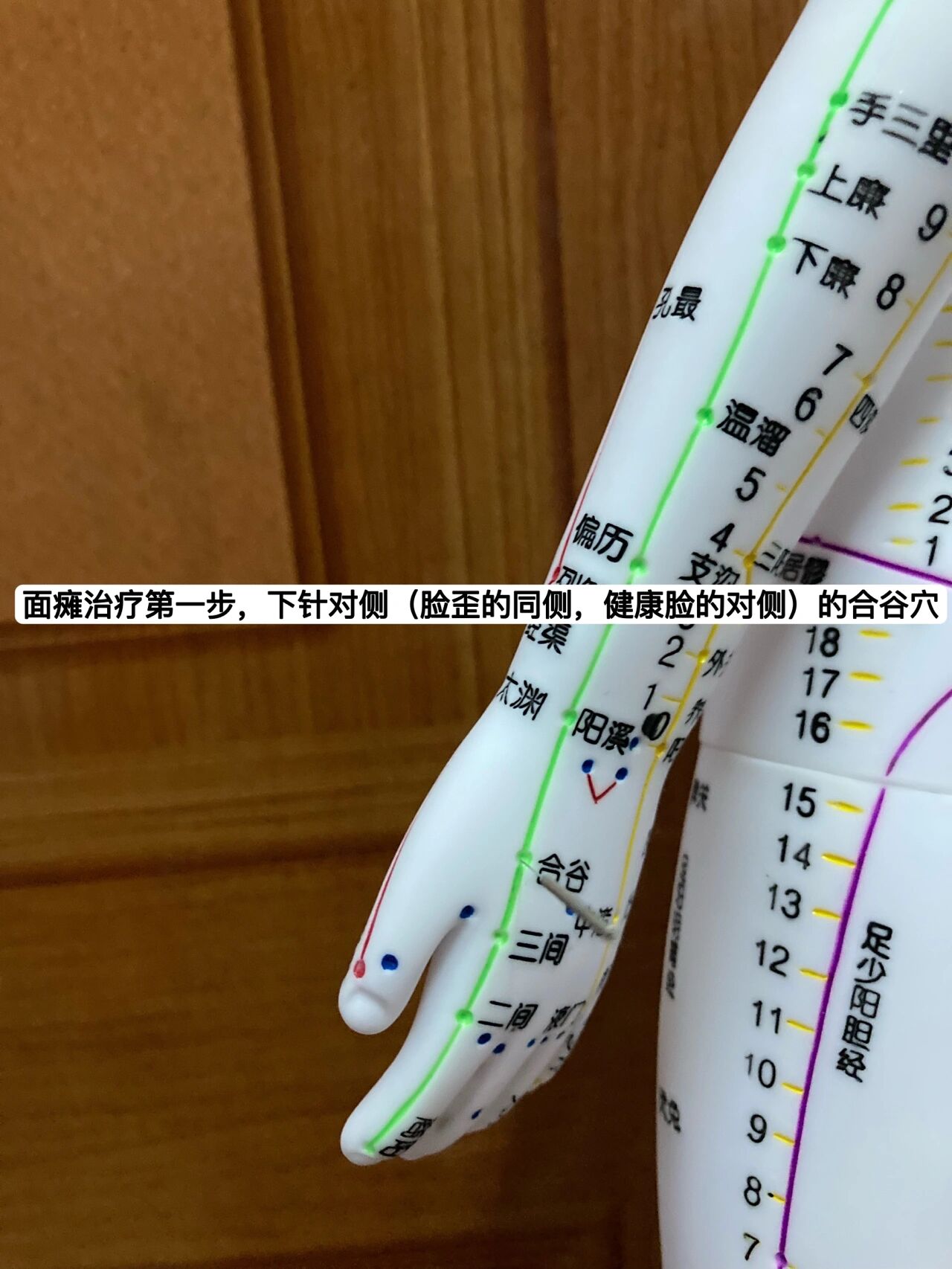 倪海厦 | 面部中风(面瘫)地仓透颊车