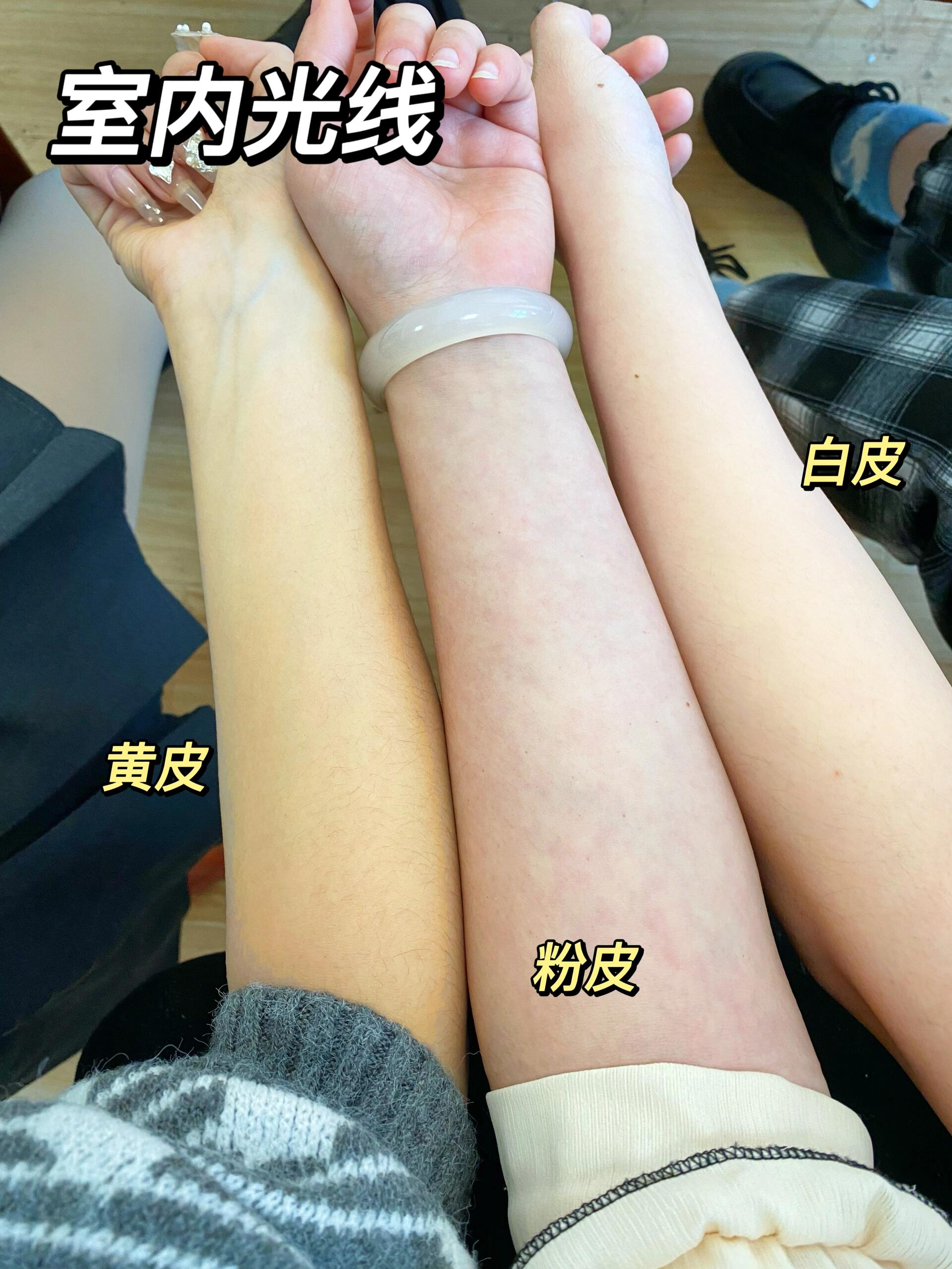 聊一聊自己的肤色7515十秒皮肤自测