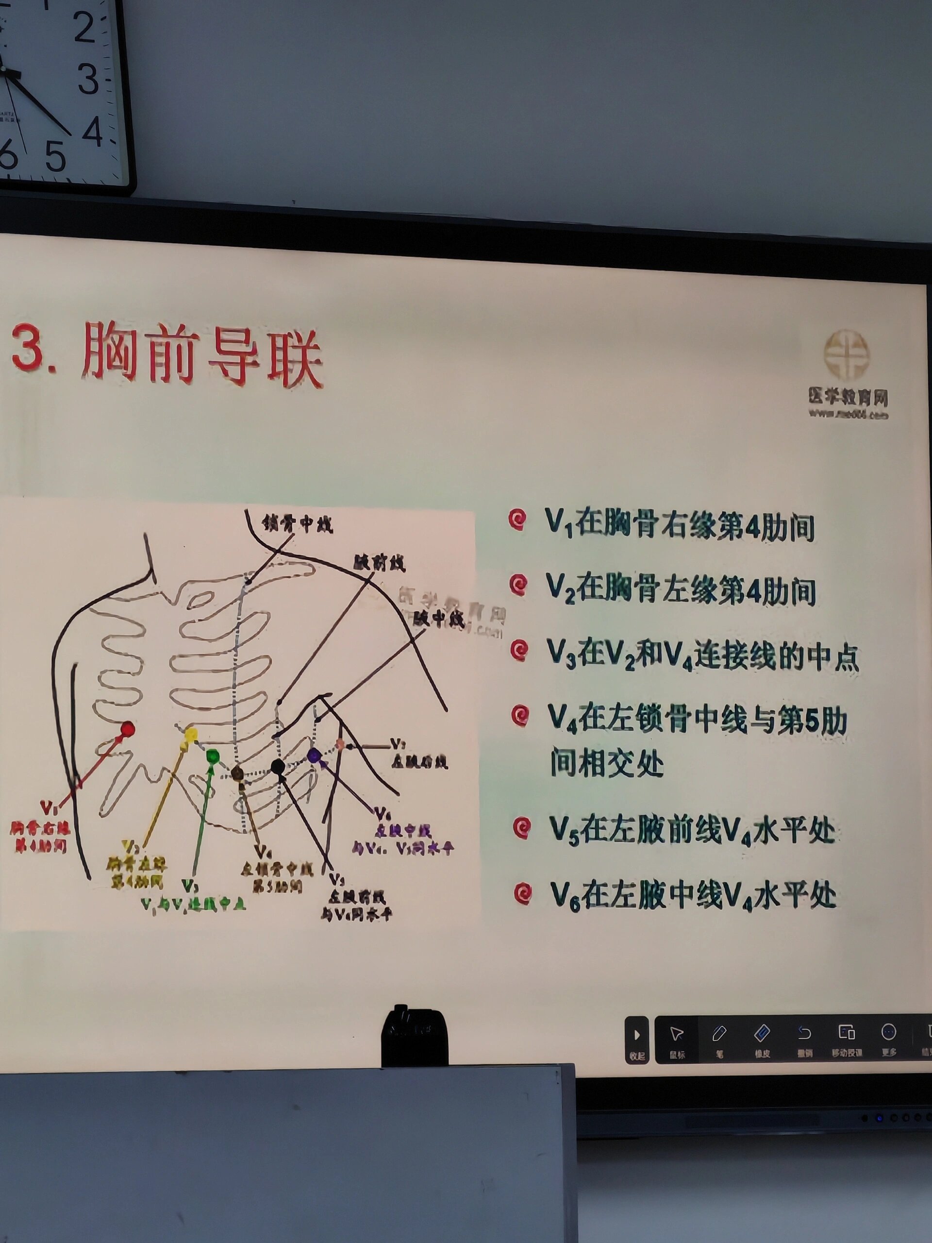 心电图胸前导联的安放位置