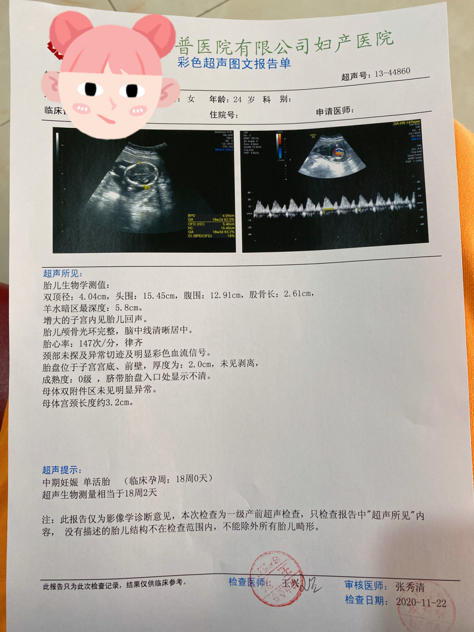 孕18周小孕期彩超03 959595 10月17做完nt后就没有拍过彩超