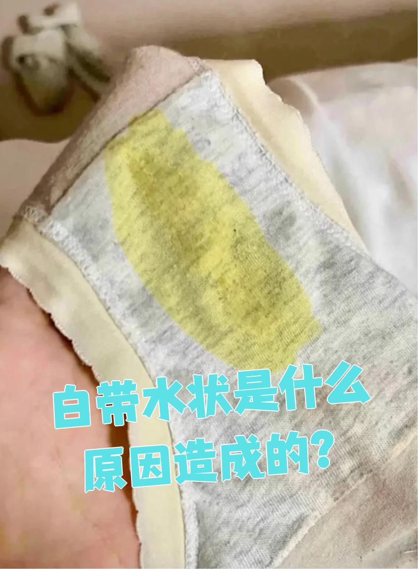 白带水状是什么原因造成的?