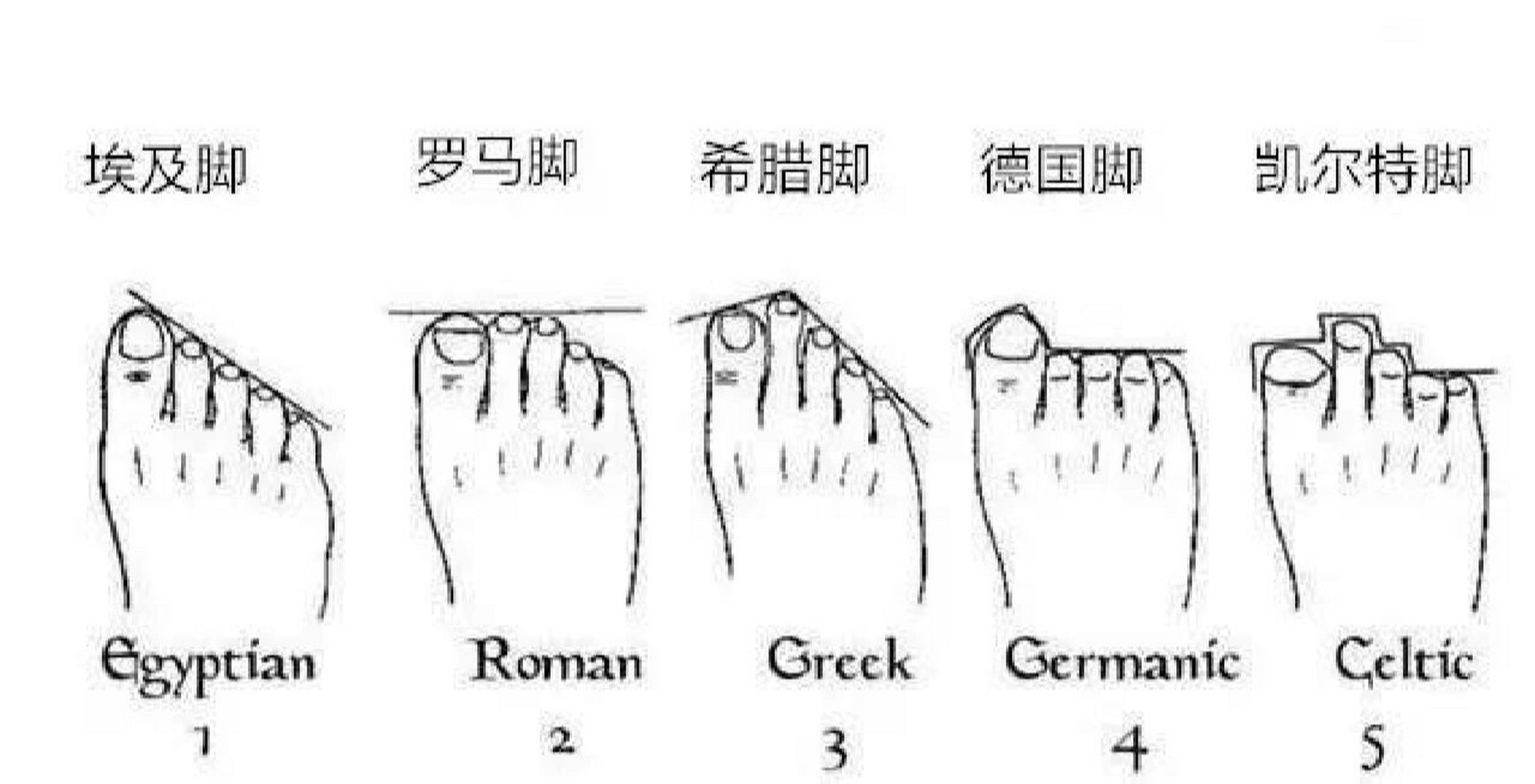 在中国最常见的是埃及脚,罗马脚和希腊脚.