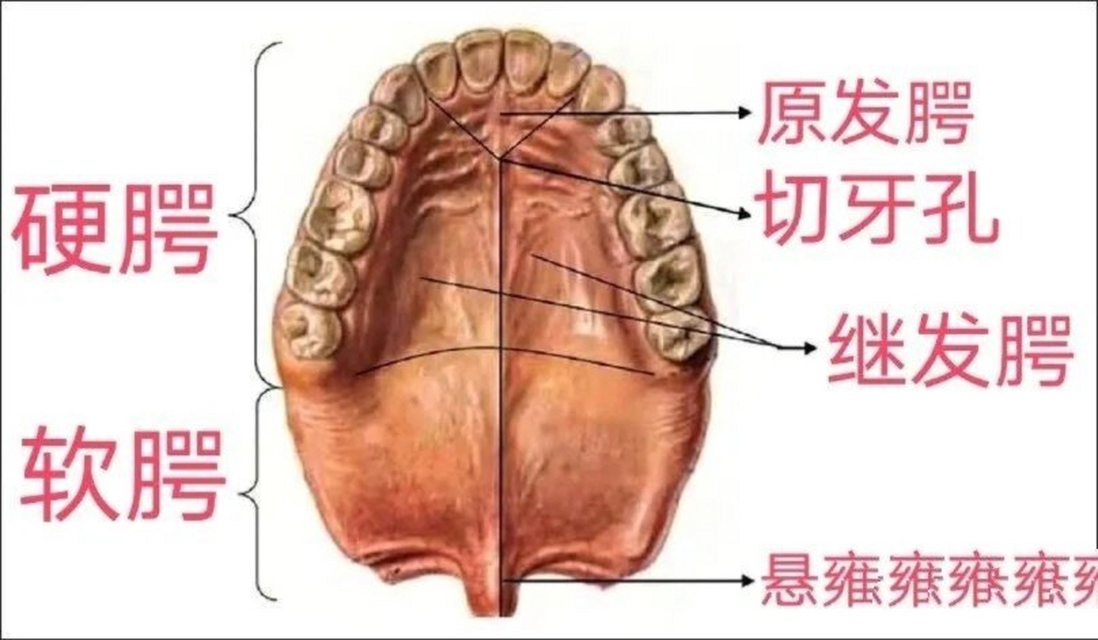 软腭与硬腭图片