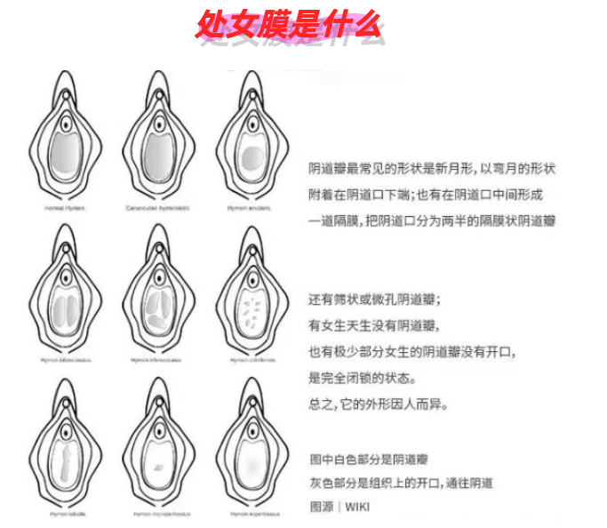 为什么第一次没有出血后来出血了?为什么在线 为什么第一次没有出血后来出血了?为什么在线