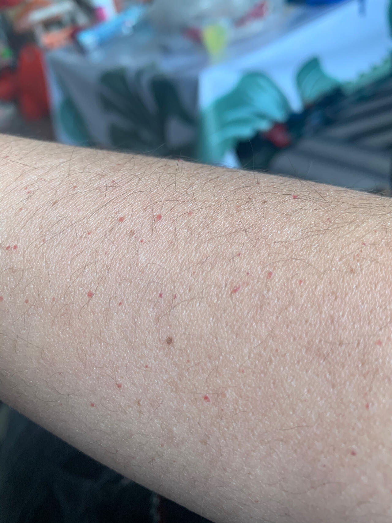 手臂好多红点