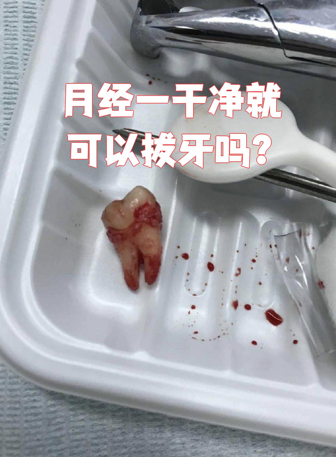 月经干净了几天可以拔牙为什么在线