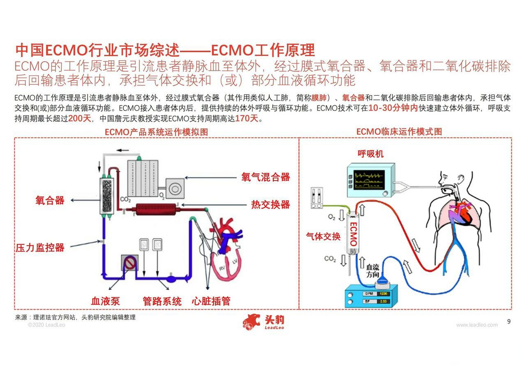 ecmo系统示意图图片