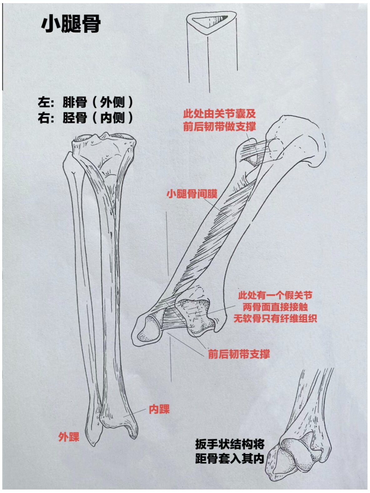 小腿骨骨折能否构成伤残十级