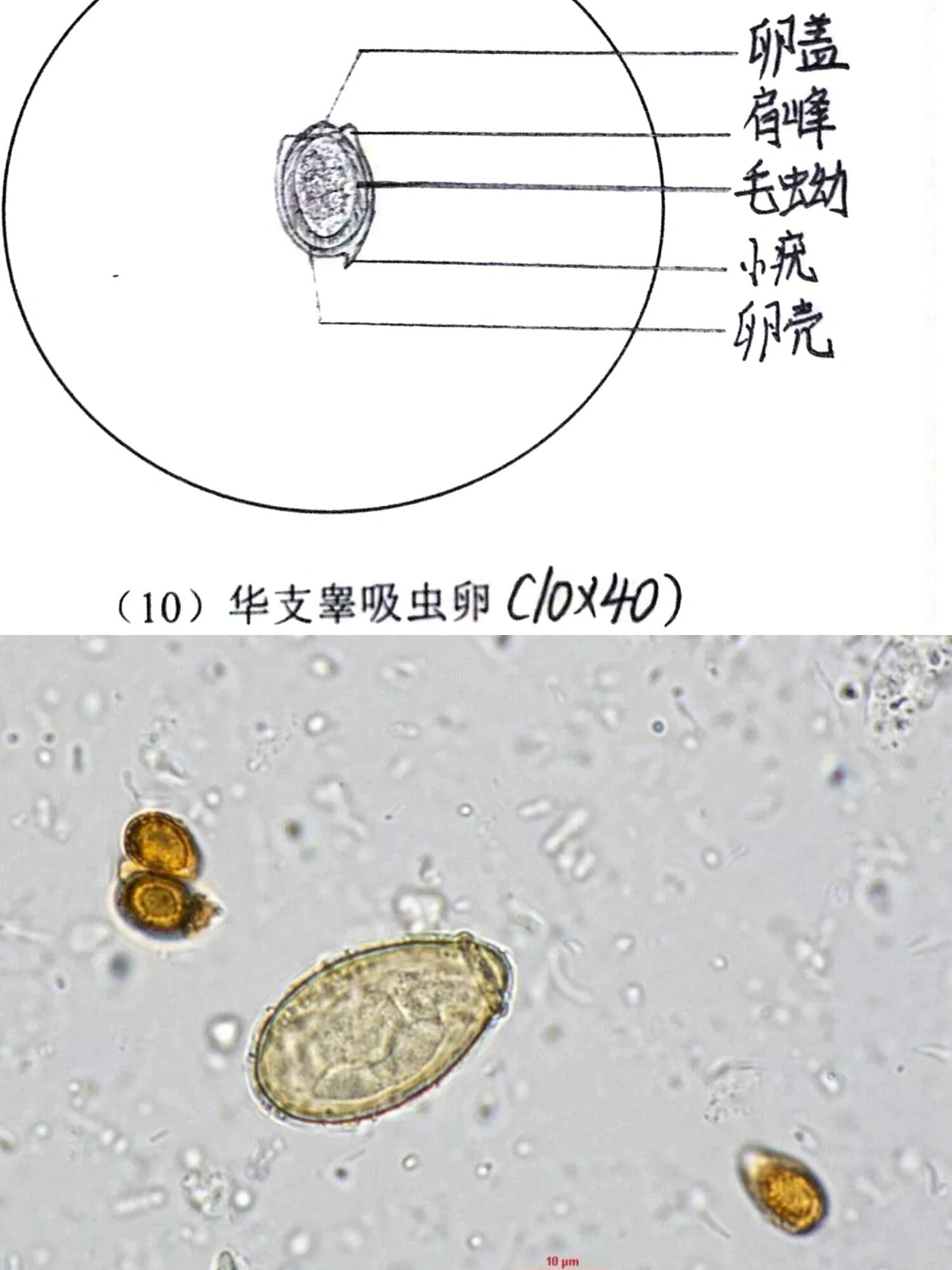 肺吸虫虫卵手绘图图片