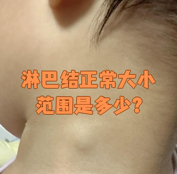 淋巴结正常情况下直径不超过0.5