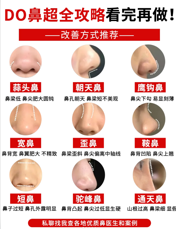 增生和假体外出的区别做鼻子用什么材料最长久最安全隆鼻时鼻头用耳