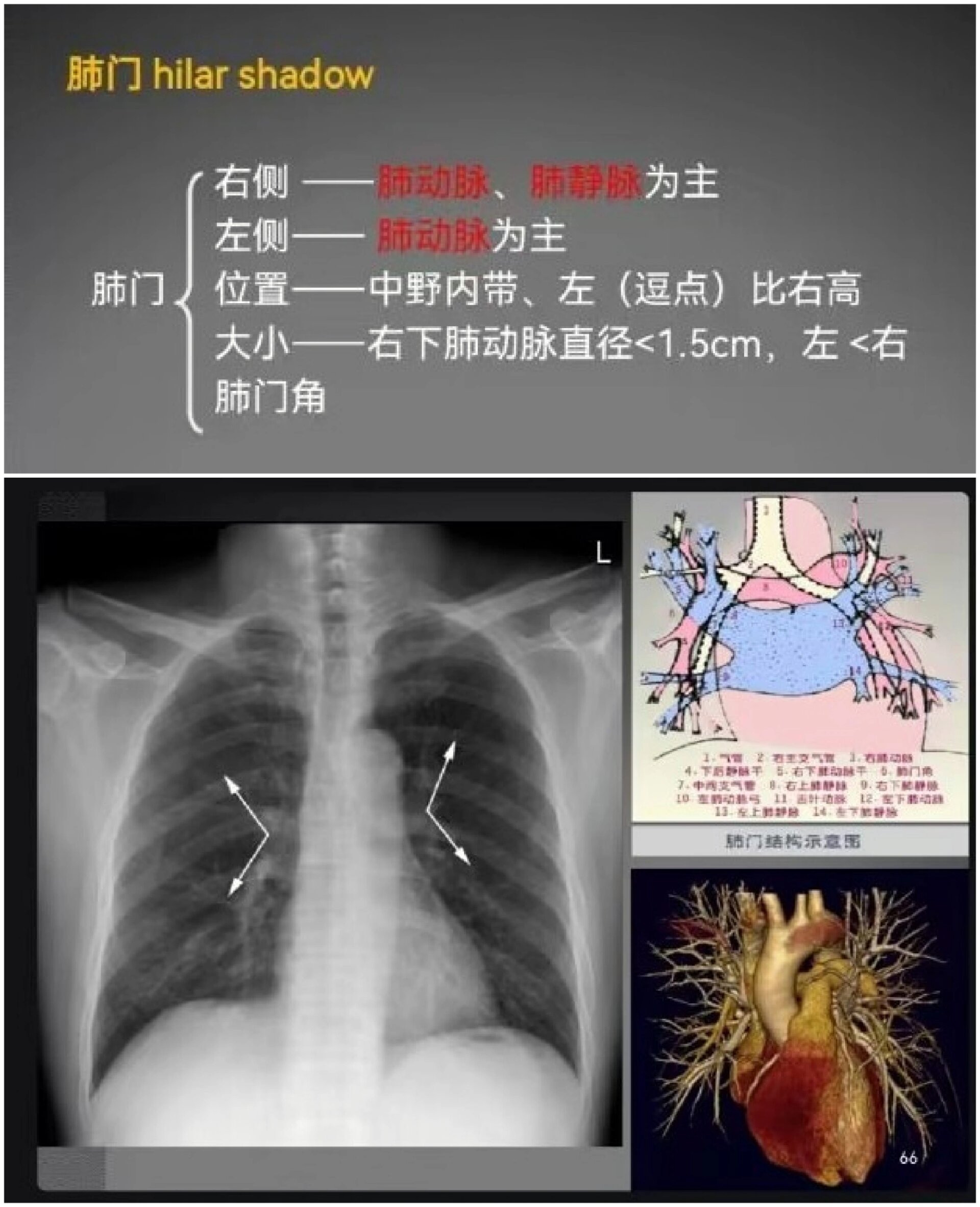 胸片部位图解图片