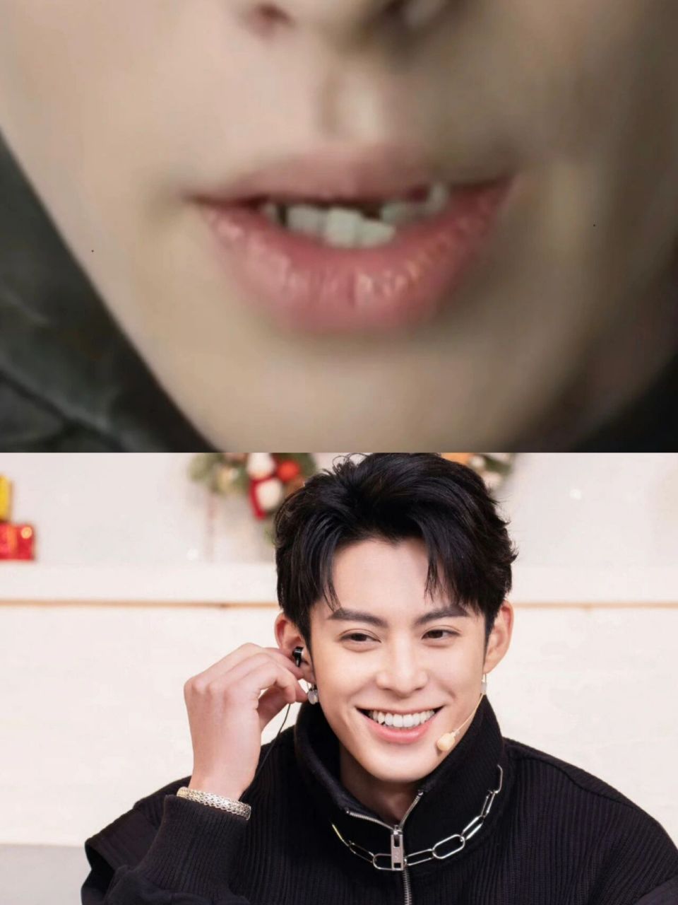 这得戴多贵的牙套才能整出王鹤棣的牙?