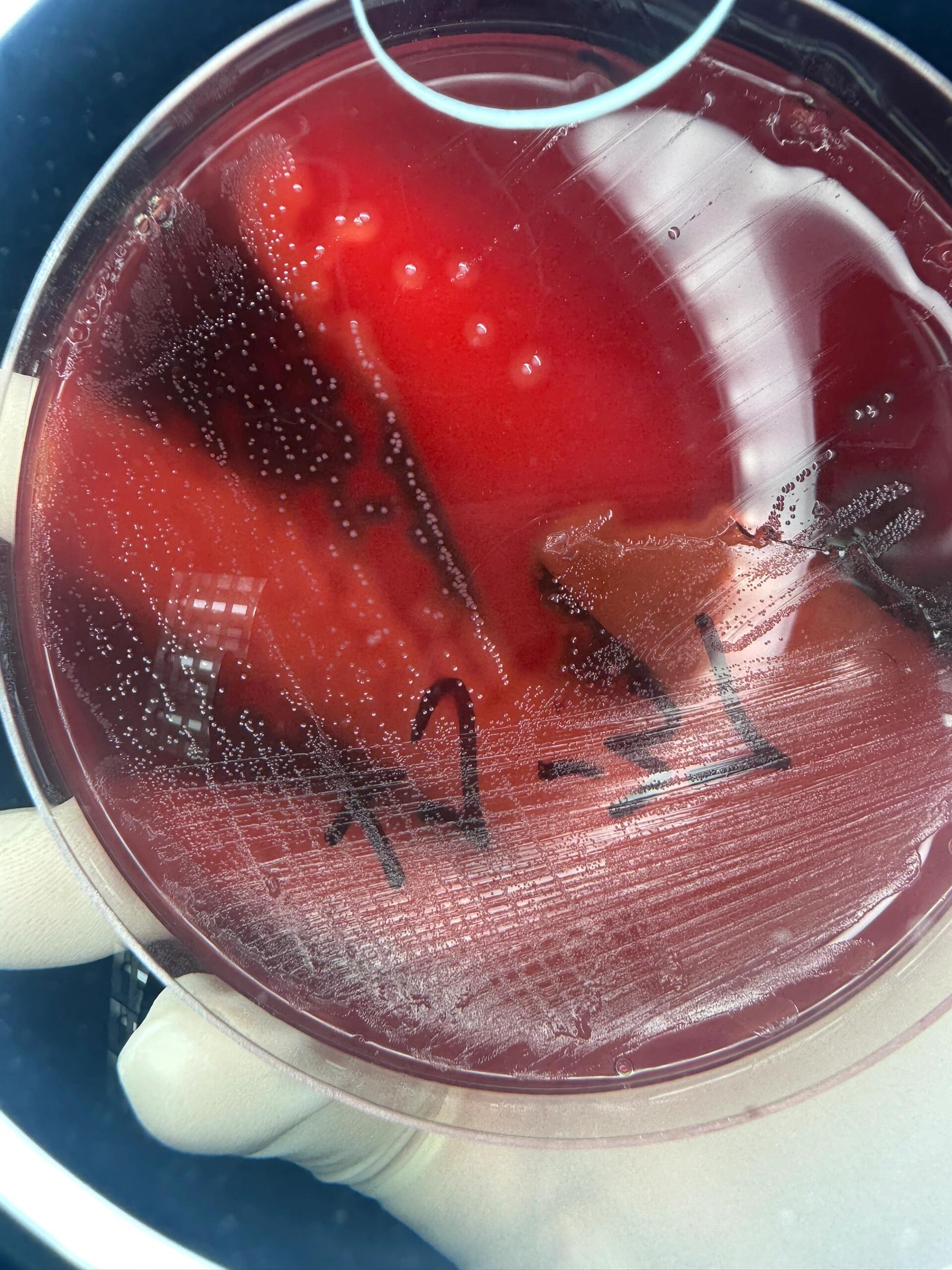 a族链球菌 化脓性链球菌 菌落形态 这两株菌都是化脓链球菌,培养时间