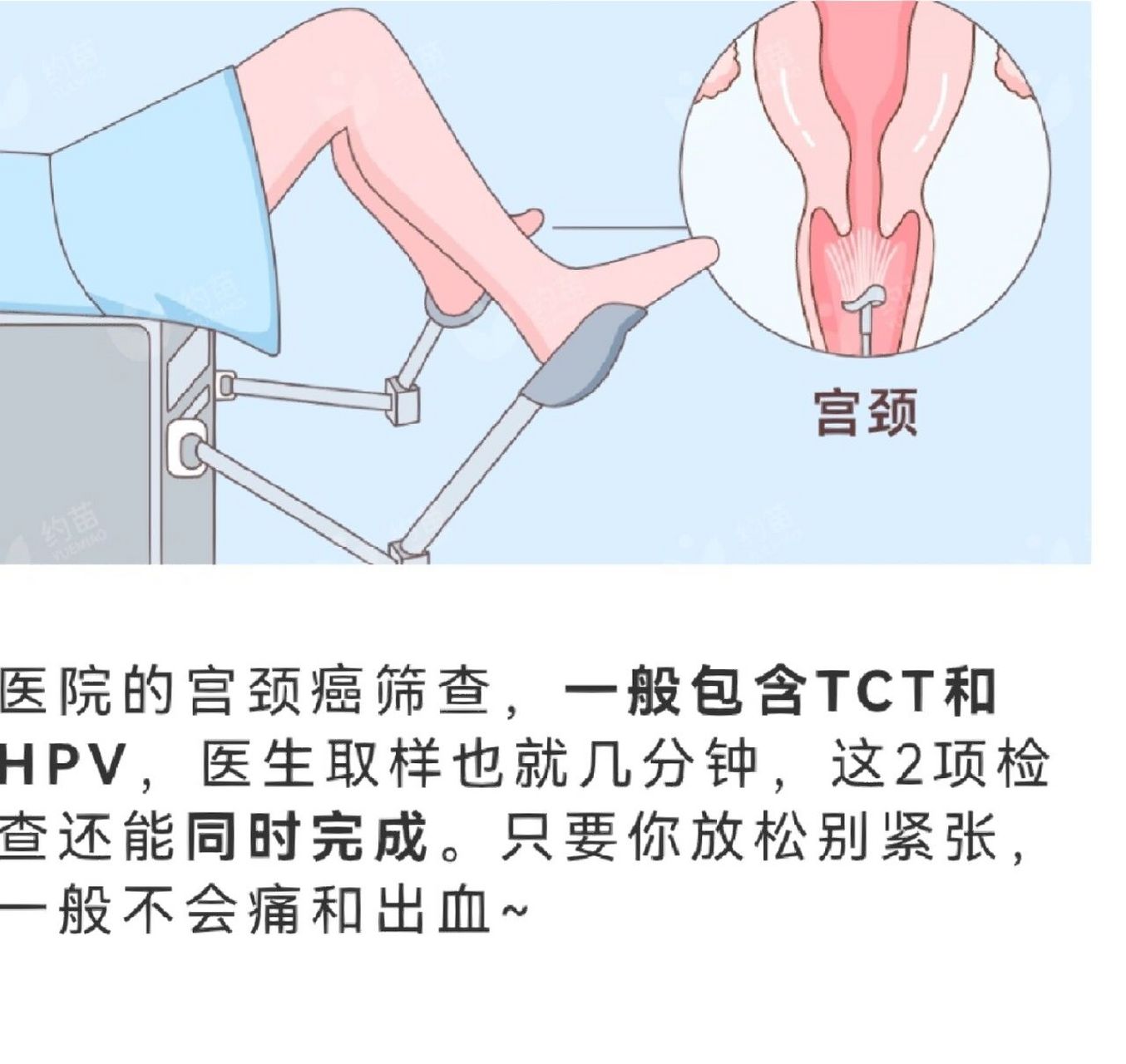 宫颈癌筛查该咋选?tct和hpv哪个好? 第一步,看区别!