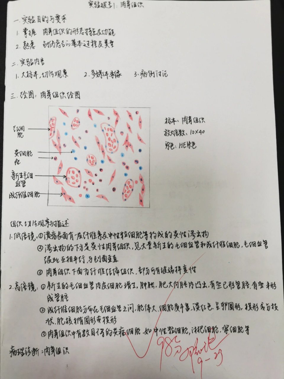 肉芽组织红蓝铅笔图片