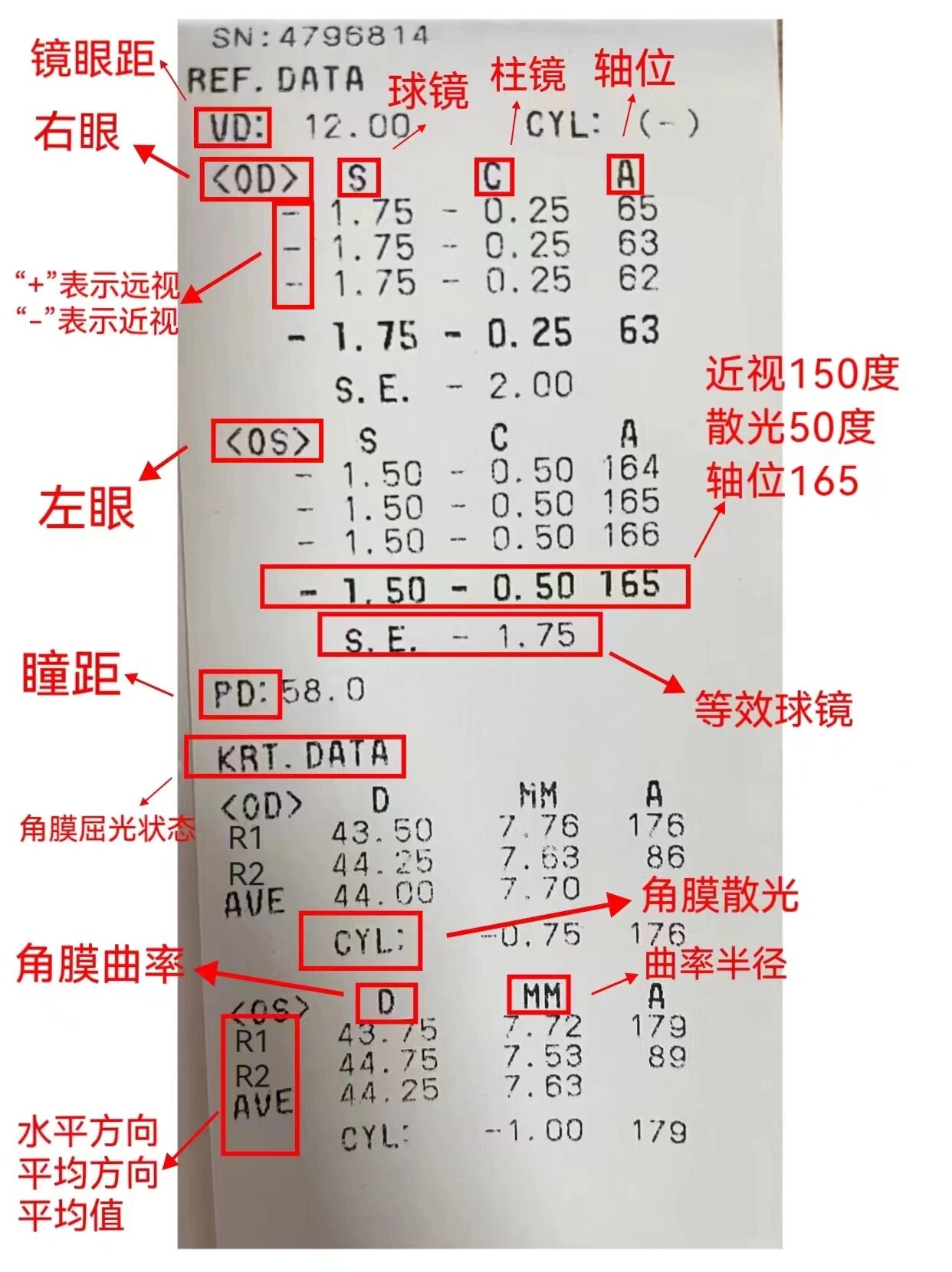 屈光球镜,柱镜,轴位图片