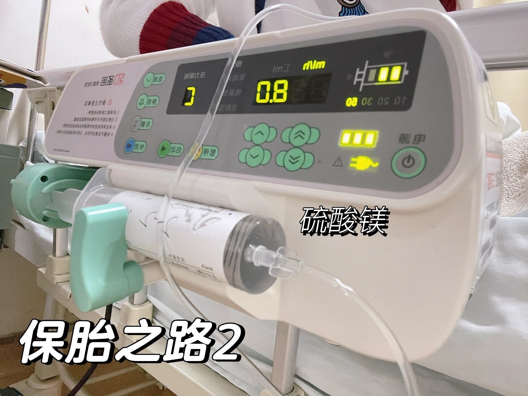 保胎之路2 硫酸镁77促肺针 四天的住院经历 住院第16615天: 1.