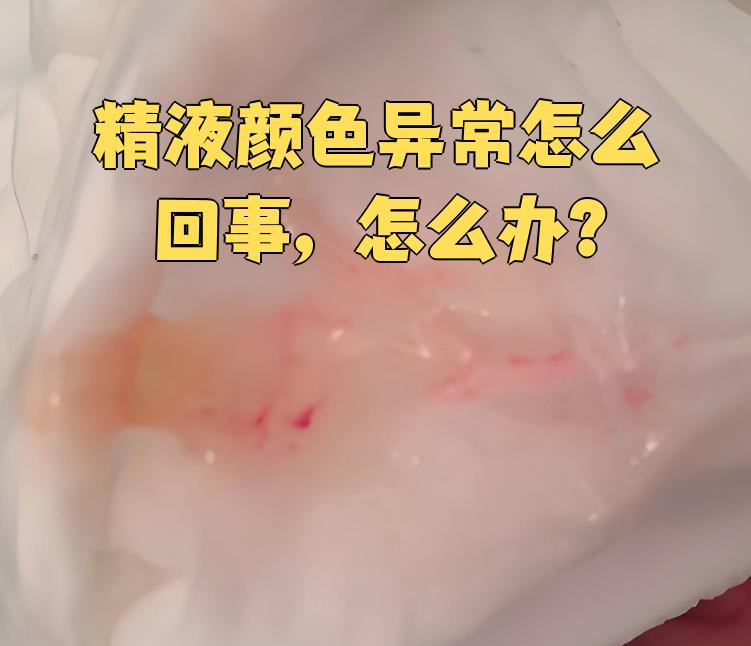 如果变成黄色,红色或带血丝,要警惕以下问题: