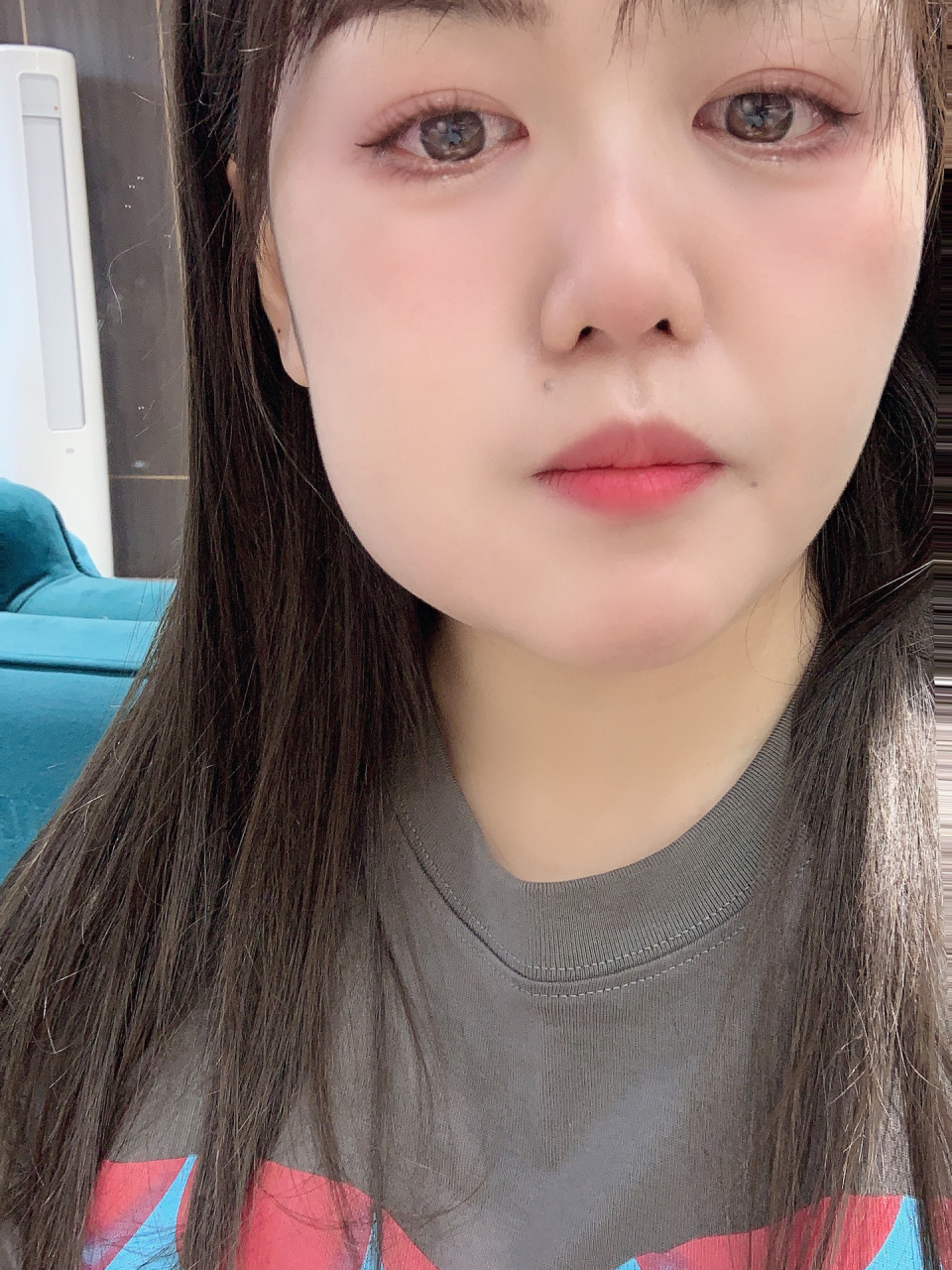 牙齿发炎脸肿了 脸肿的像包子一样,几年前做了根