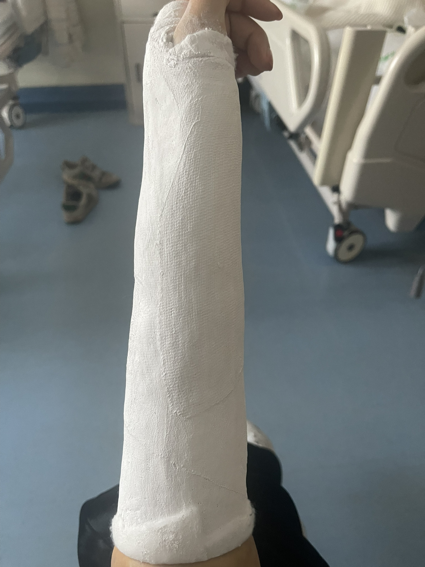 记录四次石膏 今年大年初三早上出了车祸手腕骨折 幸好老妈坐在后座没