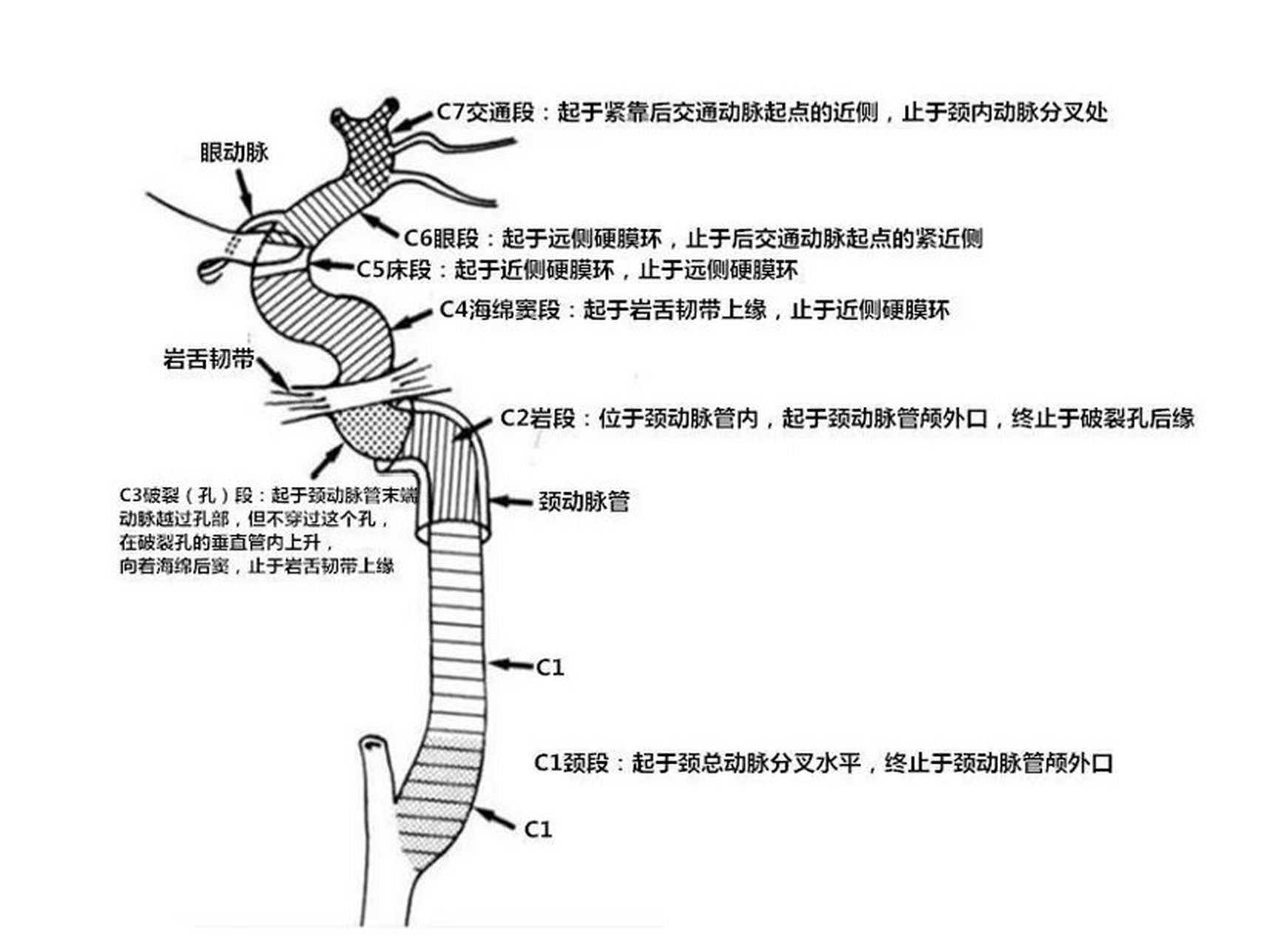 颅内动脉分段解剖图图片