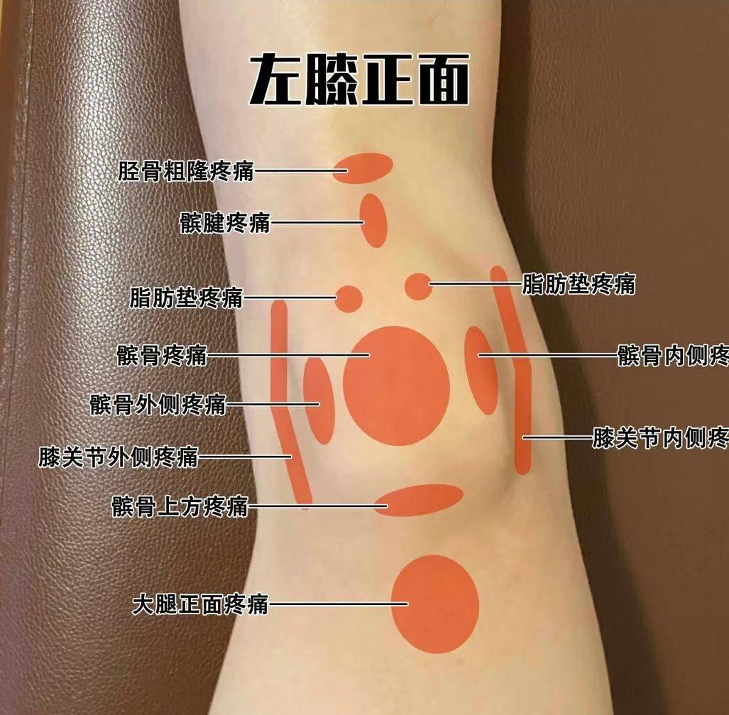 膝盖脂肪垫图片图解图片