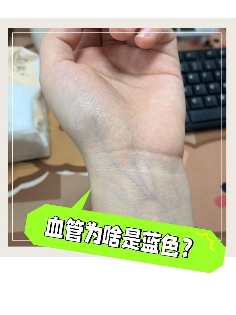 血液是红色的,为什么血管却呈现蓝色?
