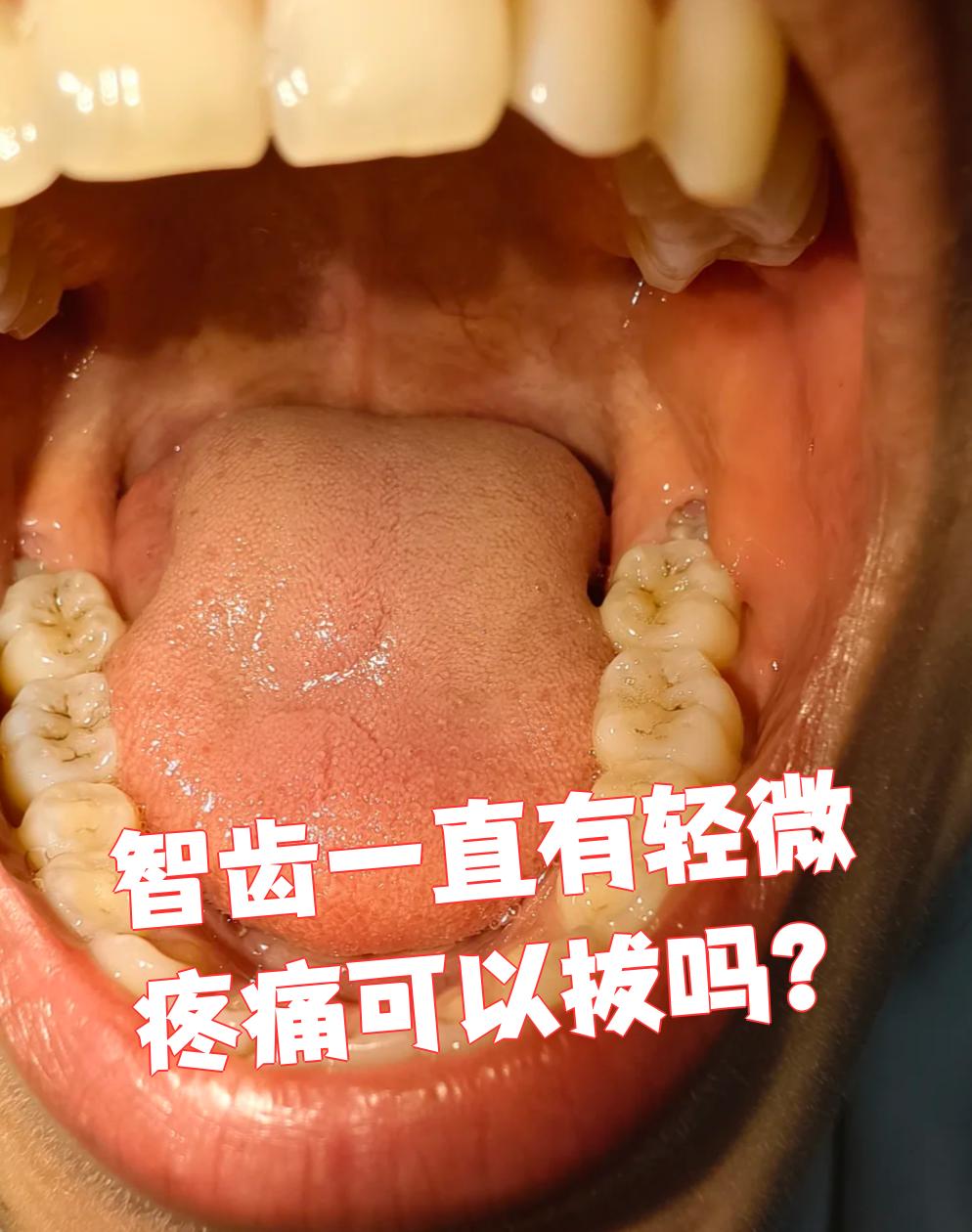 这种情况通常是智齿有慢性炎症