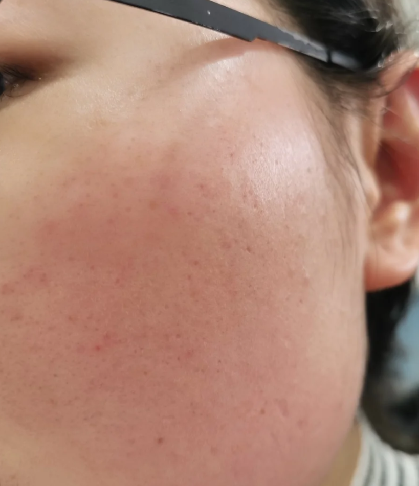 为什么脸会发红发热