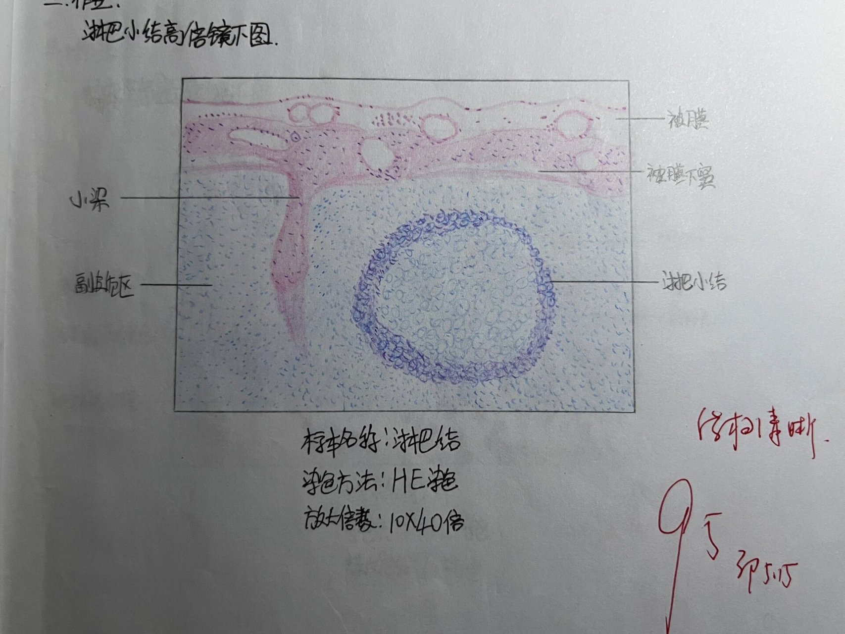 要结课了发一下,比较贴合实际不太算红蓝铅笔( p2 单层立方上皮 p3 中