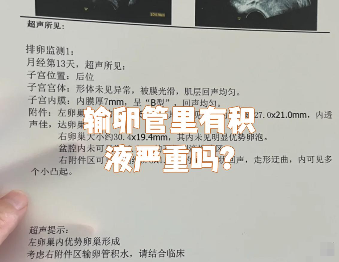 输卵管积液不算特别严重的问题,但需要重视