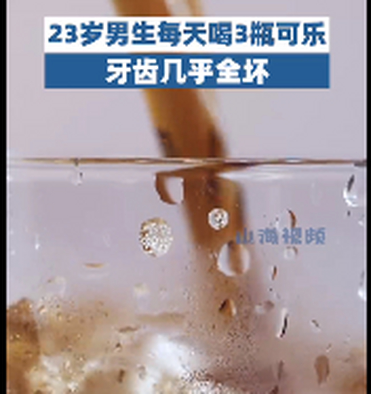 00后男生长期可乐当水喝牙全坏#【爱喝"肥宅快乐水"?