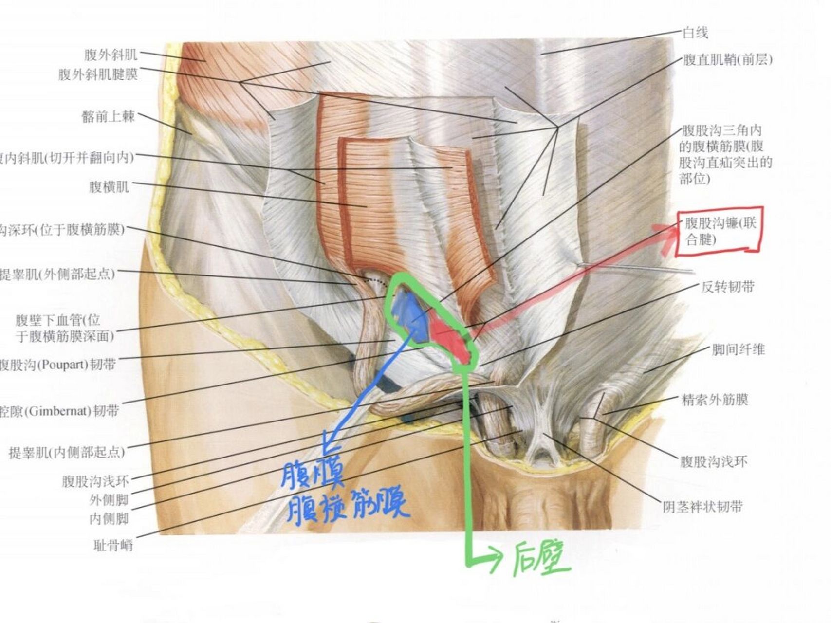 腹股沟疝位置图图片