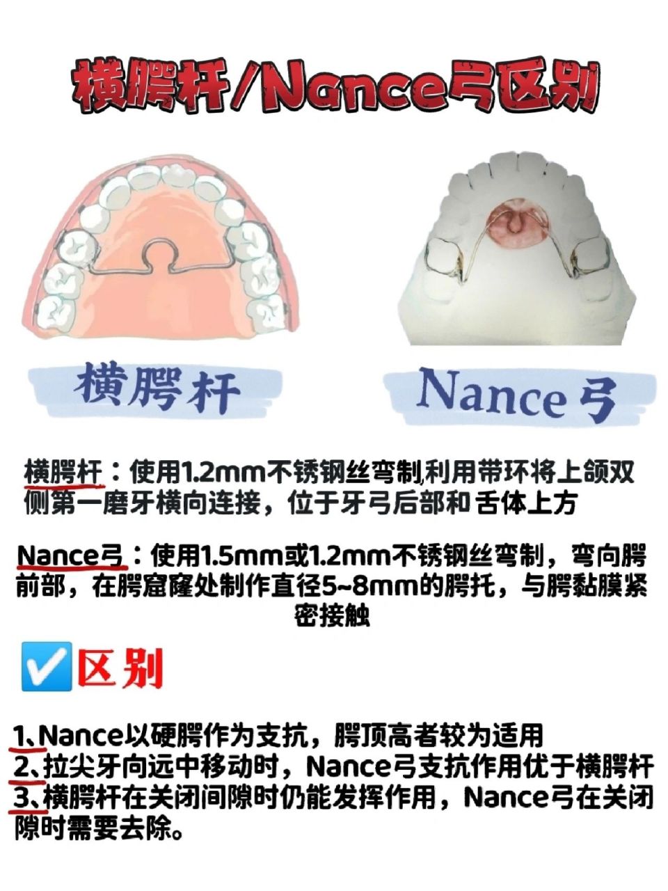 横腭杆和nance弓的区别 横腭杆和nance弓的区别 94区别 1,nance以