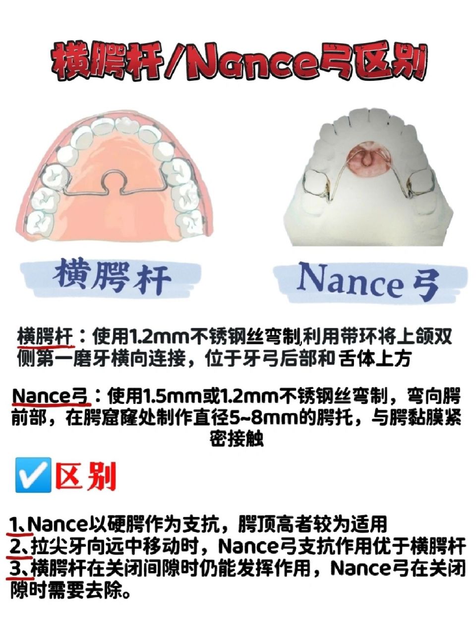 nance弓图片