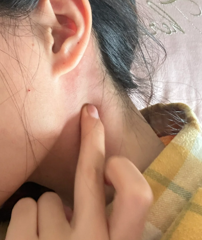 颈部扭伤一般1~3周能恢复,但具体时间要看损伤位置