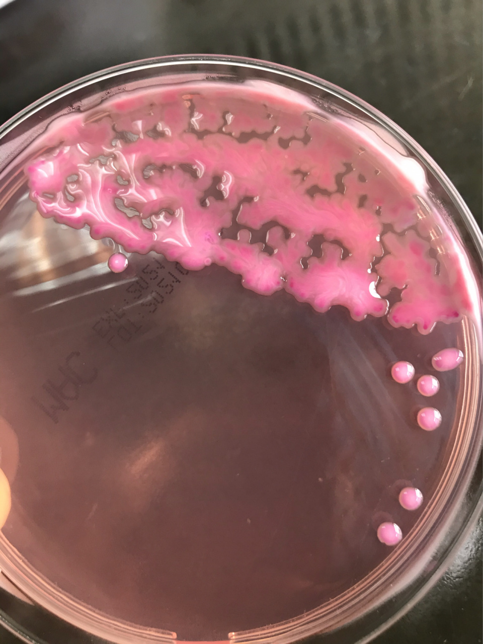 痰培养 基本上是一个肺炎克雷伯菌 血平板菌落不是常见菌落,像鼻涕一