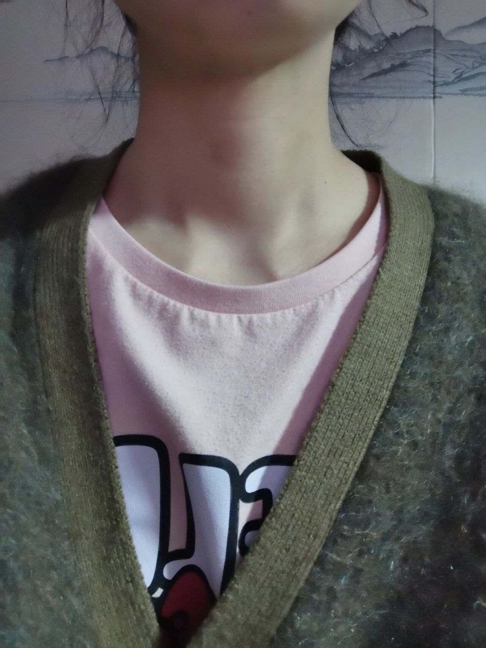 请各位红薯们帮忙看看,我的脖子是不是粗大 体检时发现甲状腺过氧化物