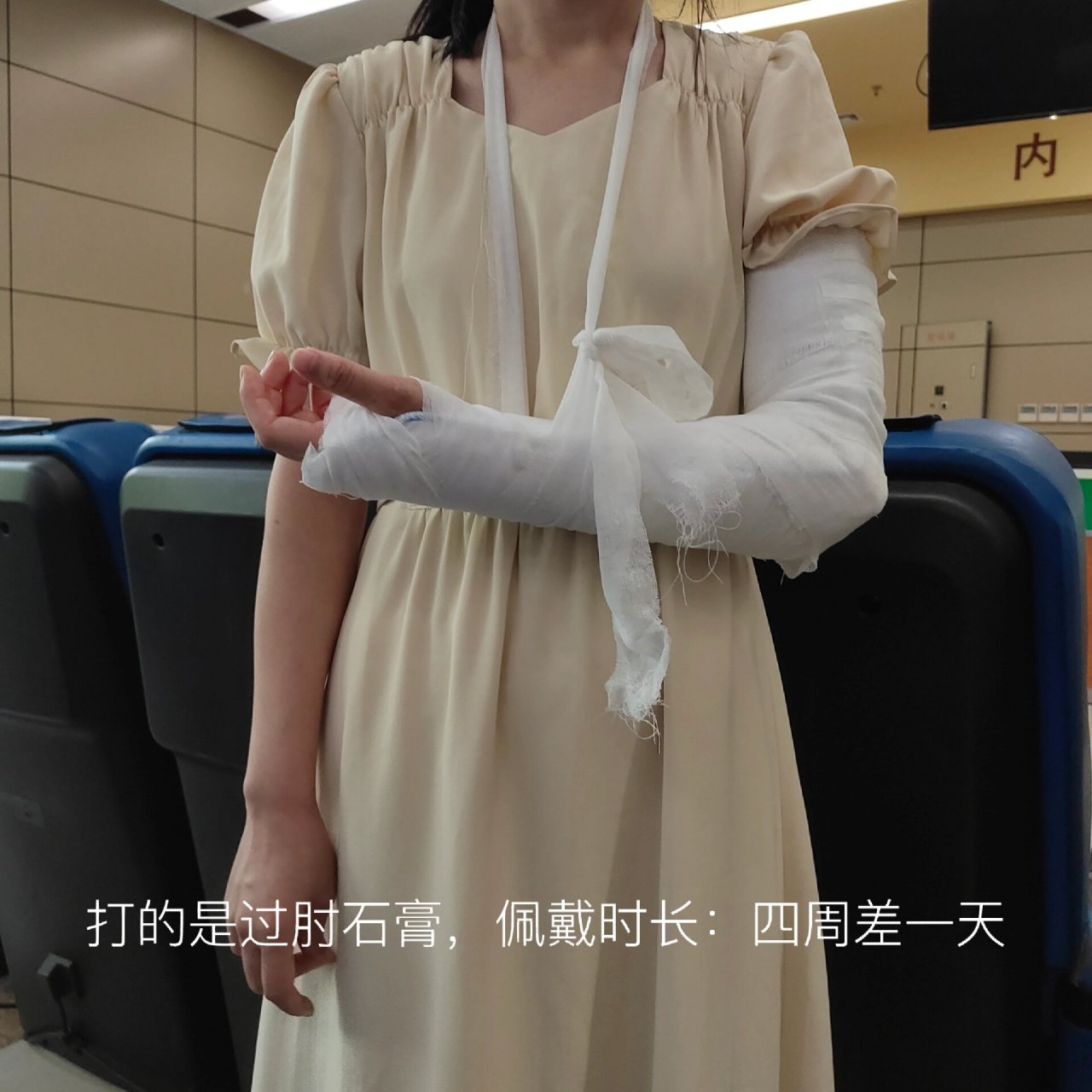 15日去二附医院拍了片子