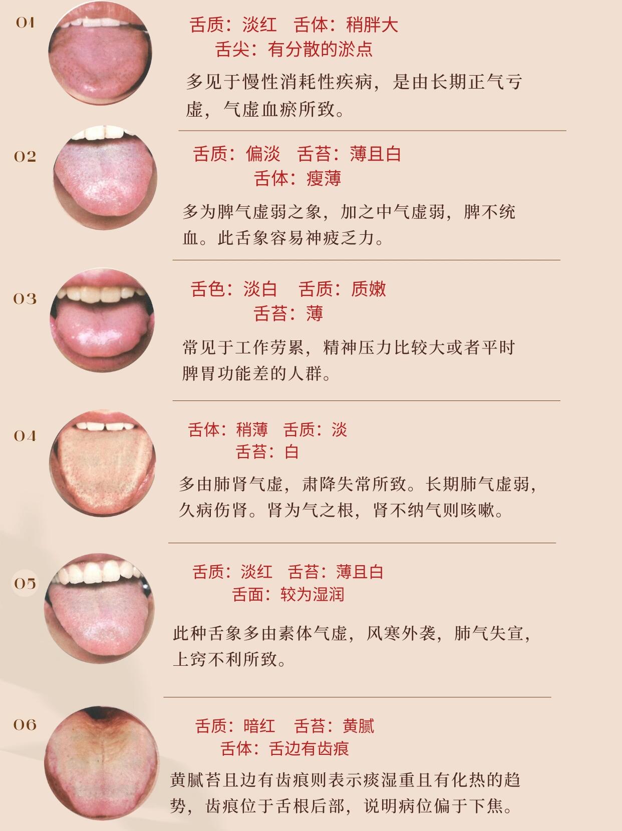 气虚舌苔图片