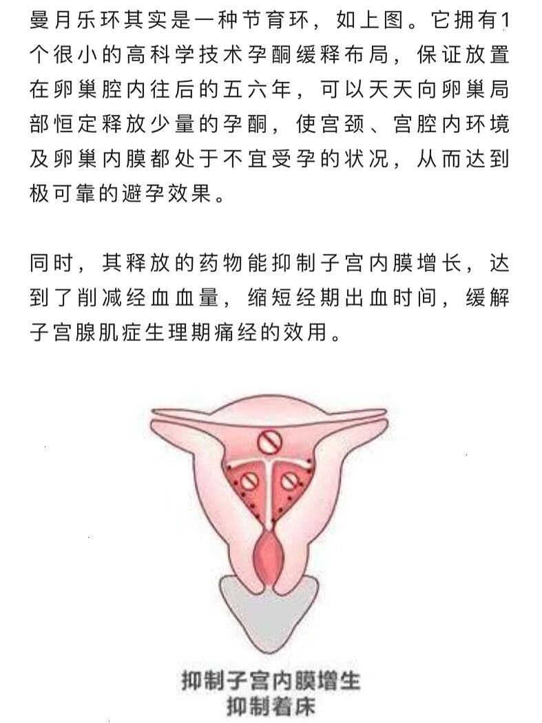 子宫病理性缩复环图片