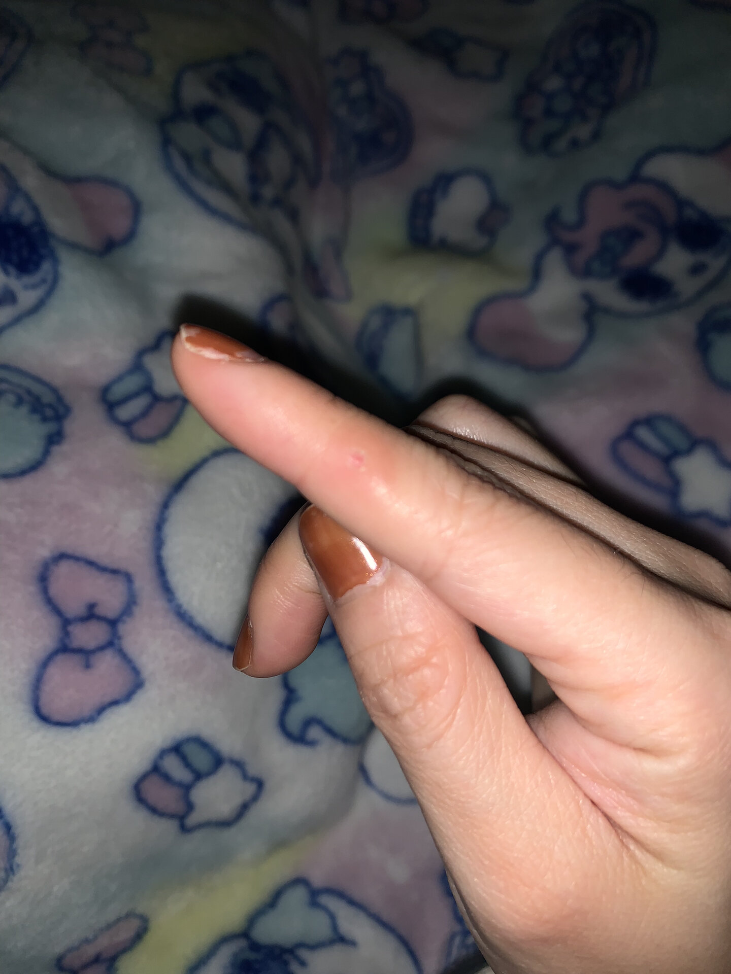 更新已痊愈 1,一开始没注意,扣过没好还大了