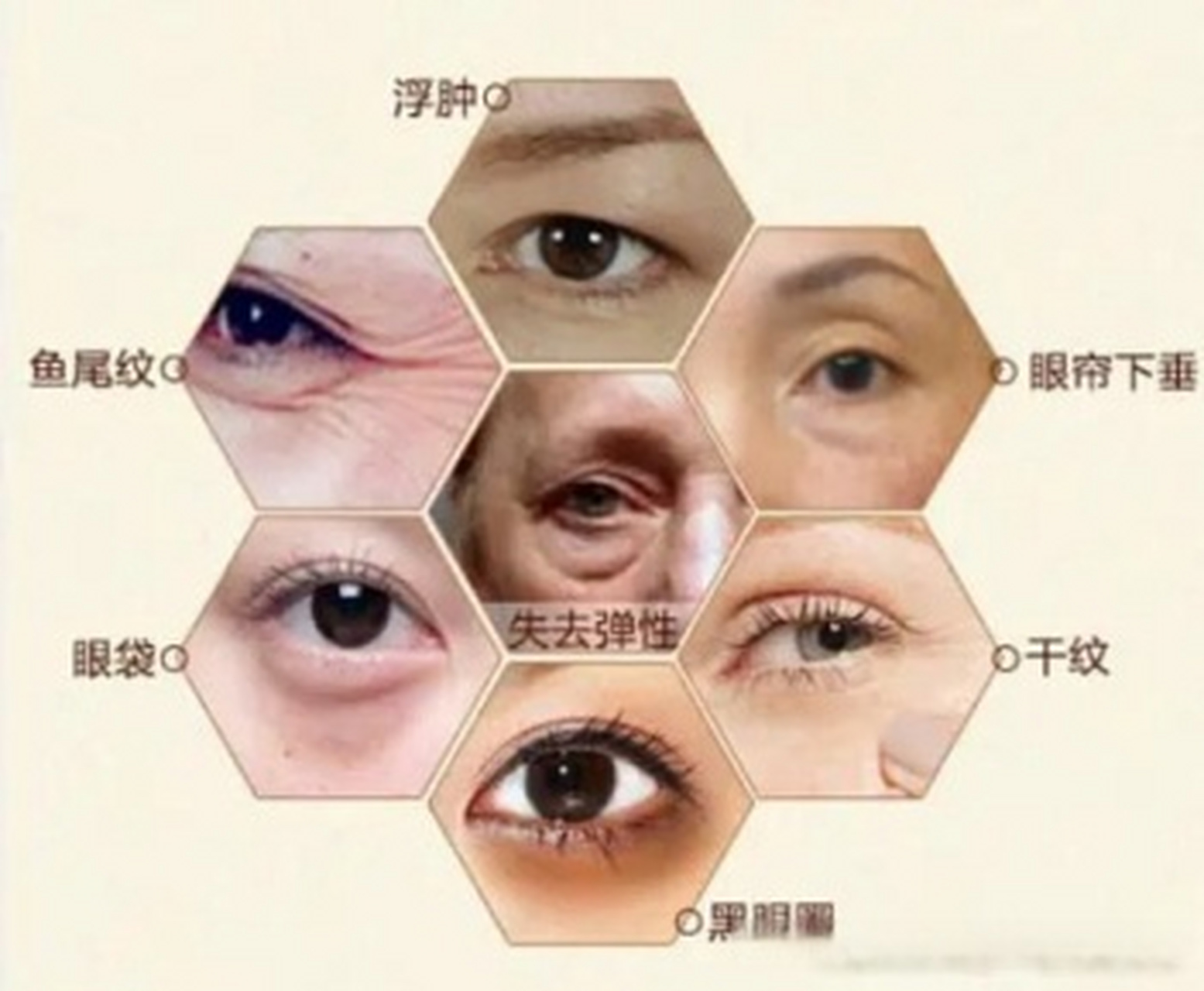 如何做好眼周年轻化?  人美先看眼,人老眼先衰.