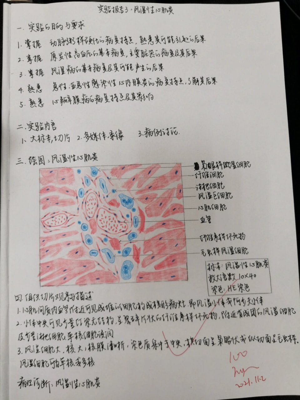 病理实验红蓝铅笔绘图3-风湿性心肌炎 【风湿性心肌炎】