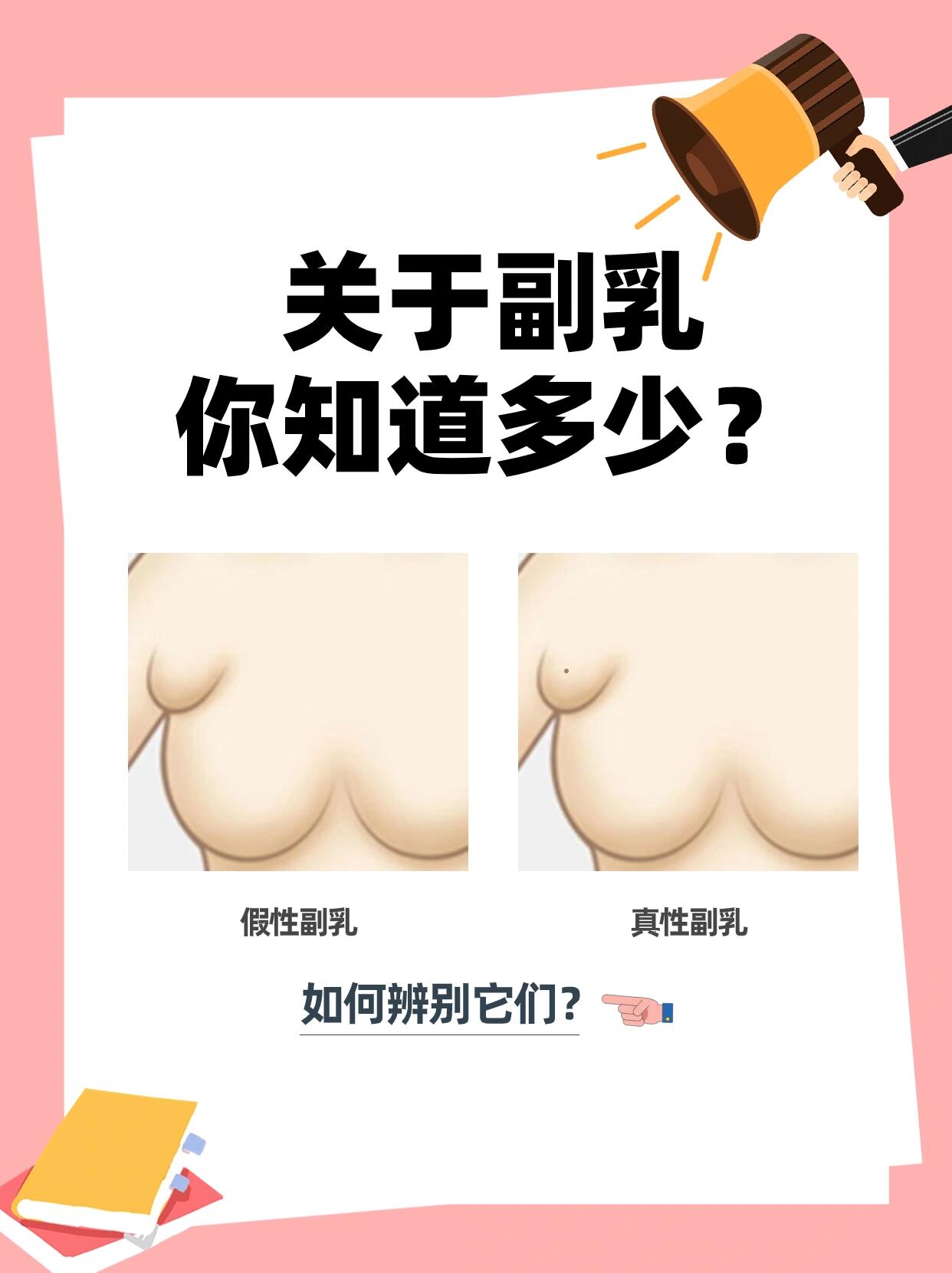 91什么是副乳?